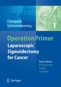 Vorderes Coverbild Laparoscopic Sigmoidectomy for Cancer