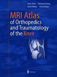 Vorderes Coverbild MRI Atlas of Orthopedics and Traumatology of the Knee