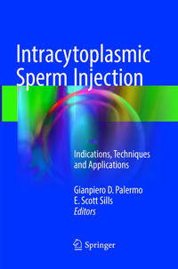 Vorderes Coverbild Intracytoplasmic Sperm Injection