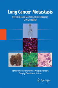 Vorderes Coverbild Lung Cancer Metastasis