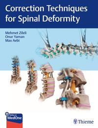 Vorderes Coverbild Correction Techniques for Spinal Deformity