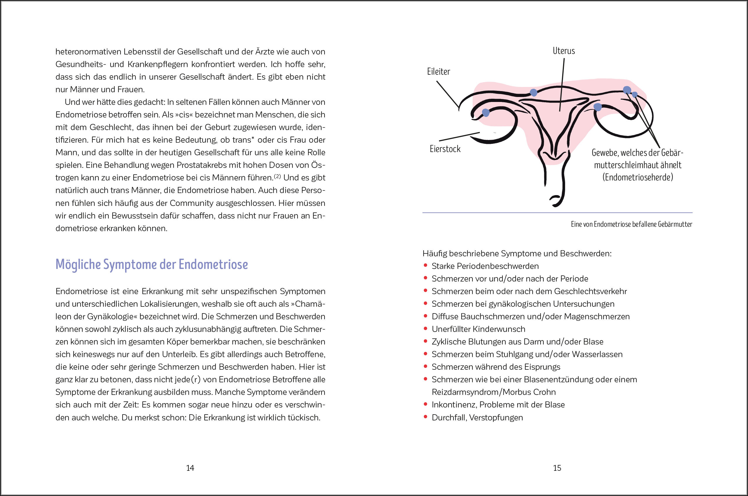 Beispielinhalt (Bild) Leben mit Endometriose