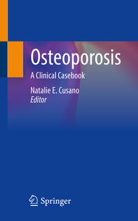 Vorderes Coverbild Osteoporosis