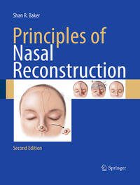 Vorderes Coverbild Principles of Nasal Reconstruction