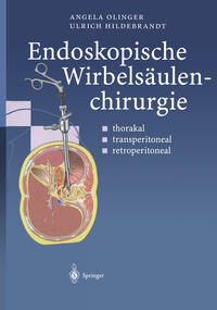 Vorderes Coverbild Endoskopische Wirbelsäulenchirurgie