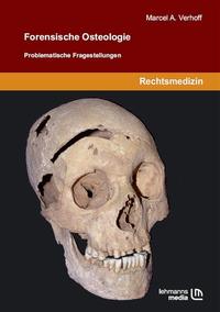 Vorderes Coverbild Forensische Osteologie