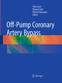 Vorderes Coverbild Off-Pump Coronary Artery Bypass