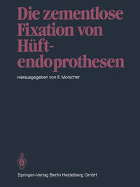 Vorderes Coverbild Die zementlose Fixation von Hüftendoprothesen