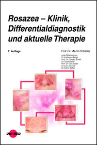 Vorderes Coverbild Rosazea – Klinik, Differentialdiagnostik und aktuelle Therapie