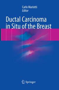 Vorderes Coverbild Ductal Carcinoma in Situ of the Breast