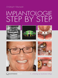 Vorderes Coverbild Implantologie Step by Step