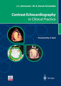 Vorderes Coverbild Contrast Echocardiography in Clinical Practice