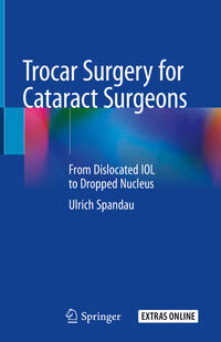 Vorderes Coverbild Trocar Surgery for Cataract Surgeons
