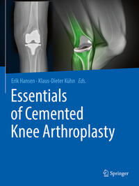 Vorderes Coverbild Essentials of Cemented Knee Arthroplasty