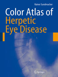 Vorderes Coverbild Color Atlas of Herpetic Eye Disease