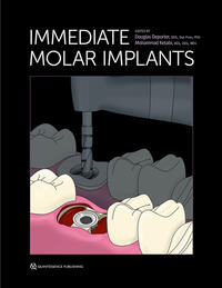 Vorderes Coverbild Immediate Molar Implants