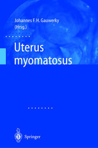 Vorderes Coverbild Uterus myomatosus