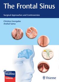 Vorderes Coverbild The Frontal Sinus