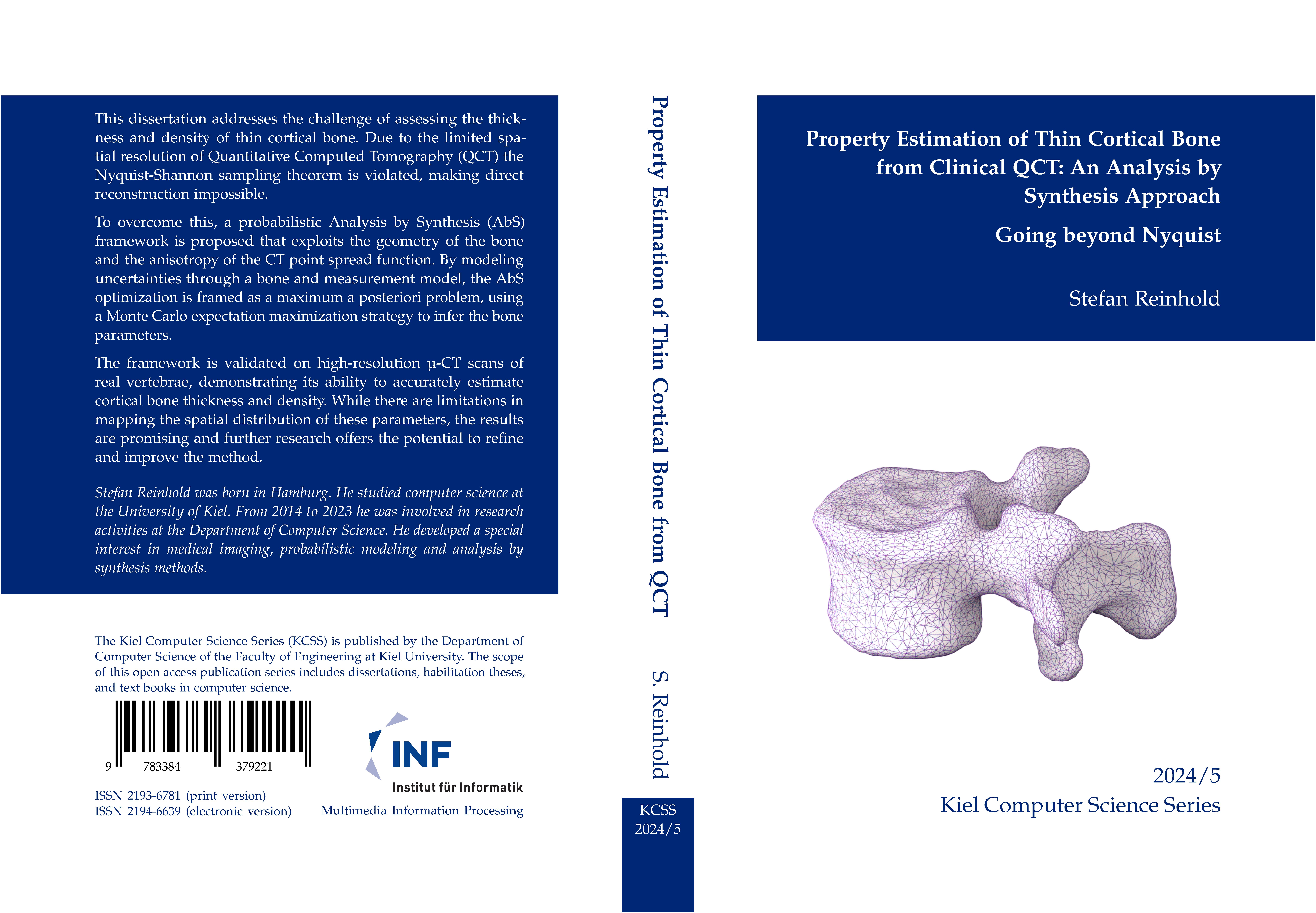 Gesamtes Coverbild Property Estimation of Thin Cortical Bone from Clinical QCT: An Analysis by Synthesis Approach