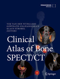 Vorderes Coverbild Clinical Atlas of Bone SPECT/CT