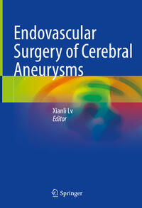 Vorderes Coverbild Endovascular Surgery of Cerebral Aneurysms