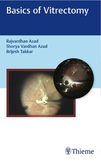 Vorderes Coverbild Basics of Vitrectomy
