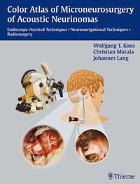 Vorderes Coverbild Color Atlas of Microsurgery of Acoustic Neurinomas