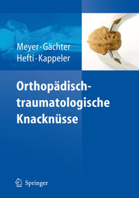 Vorderes Coverbild Orthopädisch-traumatologische Knacknüsse