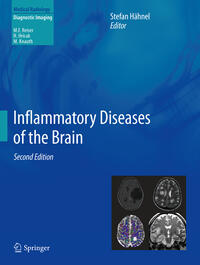 Vorderes Coverbild Inflammatory Diseases of the Brain