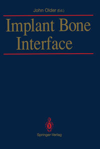 Vorderes Coverbild Implant Bone Interface