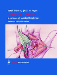 Vorderes Coverbild Dupuytren’s Disease