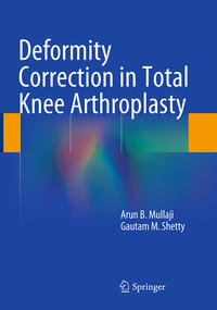 Vorderes Coverbild Deformity Correction in Total Knee Arthroplasty
