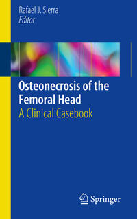 Vorderes Coverbild Osteonecrosis of the Femoral Head