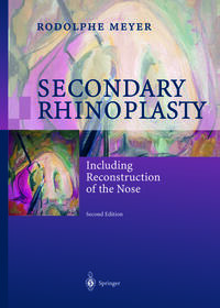 Vorderes Coverbild Secondary Rhinoplasty
