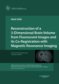 Vorderes Coverbild Reconstruction of a 3-Dimensional Brain Volume from Fluorescent Images and its Co-Registration with Magnetic Resonance Imaging