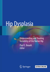 Vorderes Coverbild Hip Dysplasia