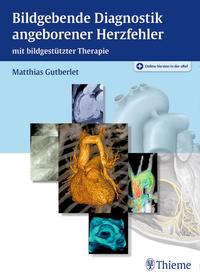 Vorderes Coverbild Bildgebende Diagnostik angeborener Herzfehler