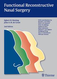 Vorderes Coverbild Functional Reconstructive Nasal Surgery