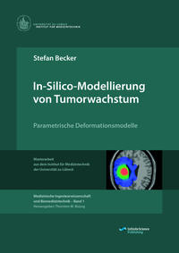 Vorderes Coverbild In-Silico-Modellierung von Tumorwachstum