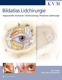 Vorderes Coverbild Bildatlas Lidchirurgie