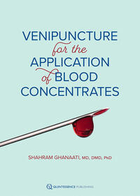 Vorderes Coverbild Venipuncture for the Application of Blood Concentrates