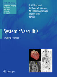Vorderes Coverbild Systemic Vasculitis
