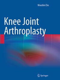 Vorderes Coverbild Knee Joint Arthroplasty