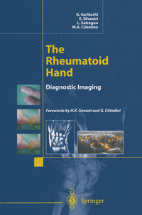 Vorderes Coverbild The Rheumatoid Hand