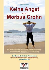 Vorderes Coverbild Keine Angst vor Morbus Crohn