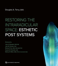 Vorderes Coverbild Restoring the Intraradicular Space