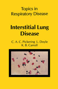 Vorderes Coverbild Interstitial Lung Disease