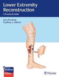 Vorderes Coverbild Lower Extremity Reconstruction