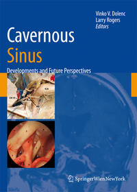 Vorderes Coverbild Cavernous Sinus