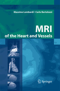 Vorderes Coverbild MRI of the Heart and Vessels